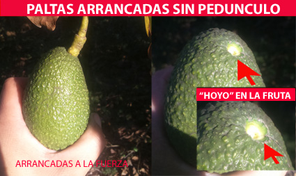 SIN-PEDUNCULO